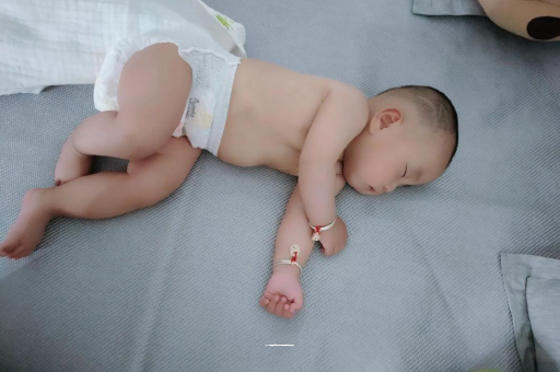 阿克苏宝宝头上长痱子